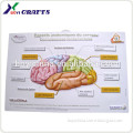 pvc Depression Poster, PVC MEDICAL POSTER A2 SIZE, pvc embossed brain posters